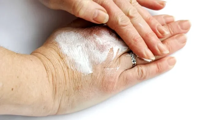 Cum repari pielea uscată a mâinilor