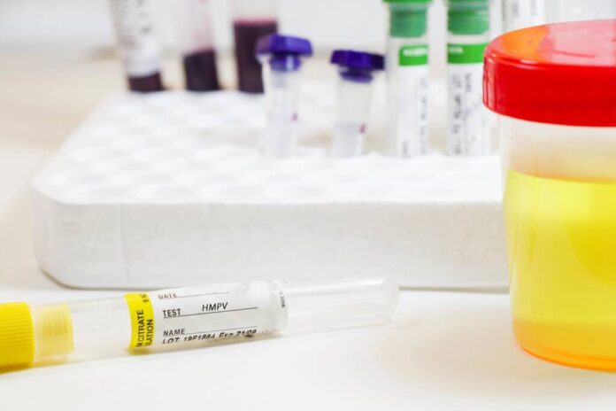 Se repetă coșmarul din 2019? Un nou virus amenință omenirea