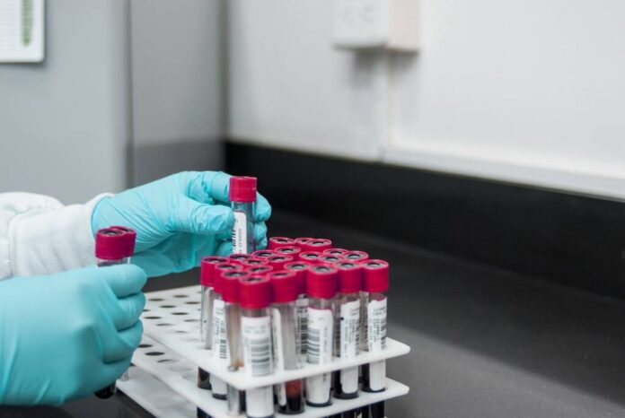 Analize medicale gratuite, în Comuna Vama Buzăului