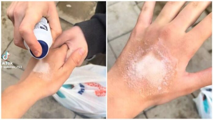 Răni de spray pe piele, o nouă provocare pe TikTok, a ajuns și în România