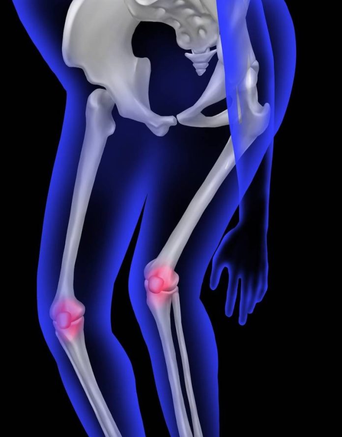 Osteoporoza: Tot ce trebuie să știți despre fragilitatea oaselor și prevenție