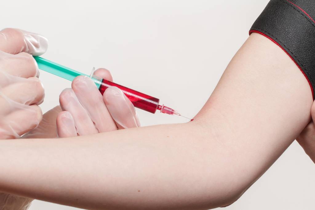 Diabetul de tip 5, recunoscut oficial. Ghid clar al principalelor forme de diabet