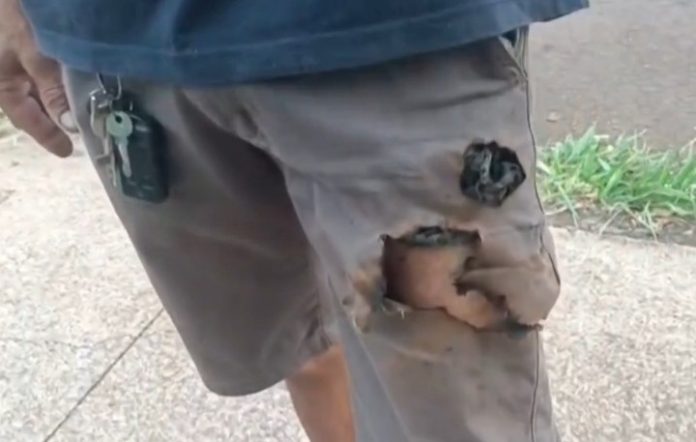 Un bărbat atacat de câini a fost salvat în mod neașteptat de explozia telefonului din buzunar