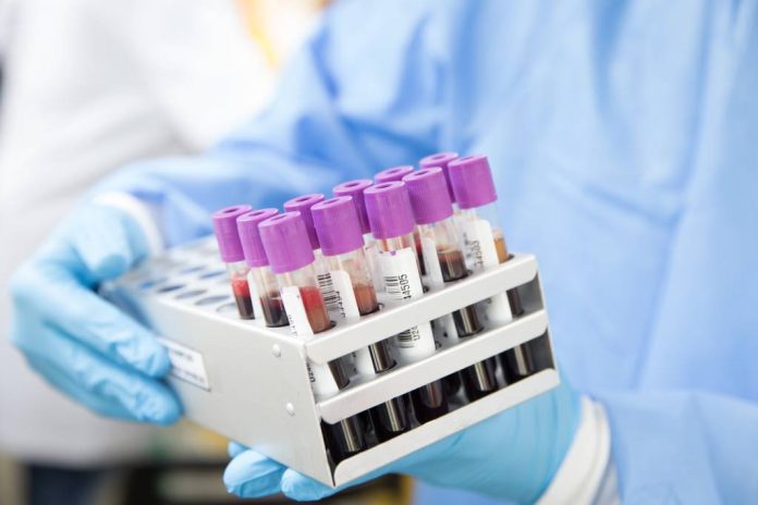 CAS Brașov anunță furnizorii de servicii medicale paraclinice cu fonduri disponibile